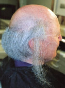building full head of hair before