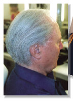 building full head of hair after