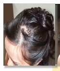 female hair before toppik filler