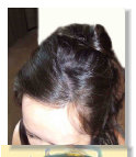 female hair after toppik filler