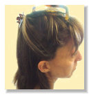 female hair after toppik filler