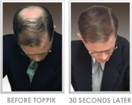 male before and after toppik