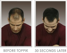 male before and after toppik